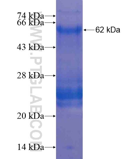 AHRR fusion protein Ag20256 SDS-PAGE AHRR fusion protein Ag20256 SDS-PAGE