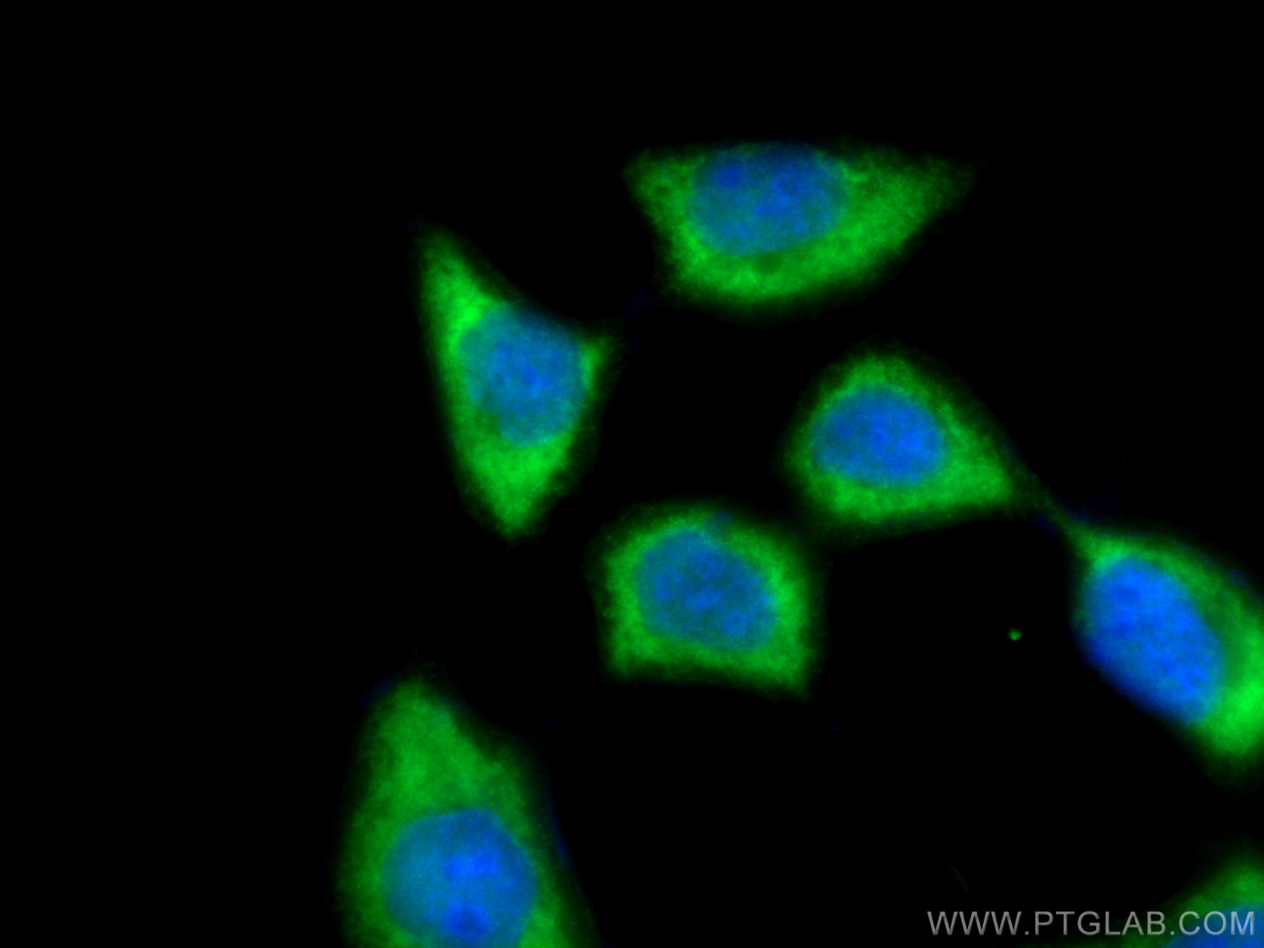 IF Staining of A431 using 14725-1-AP