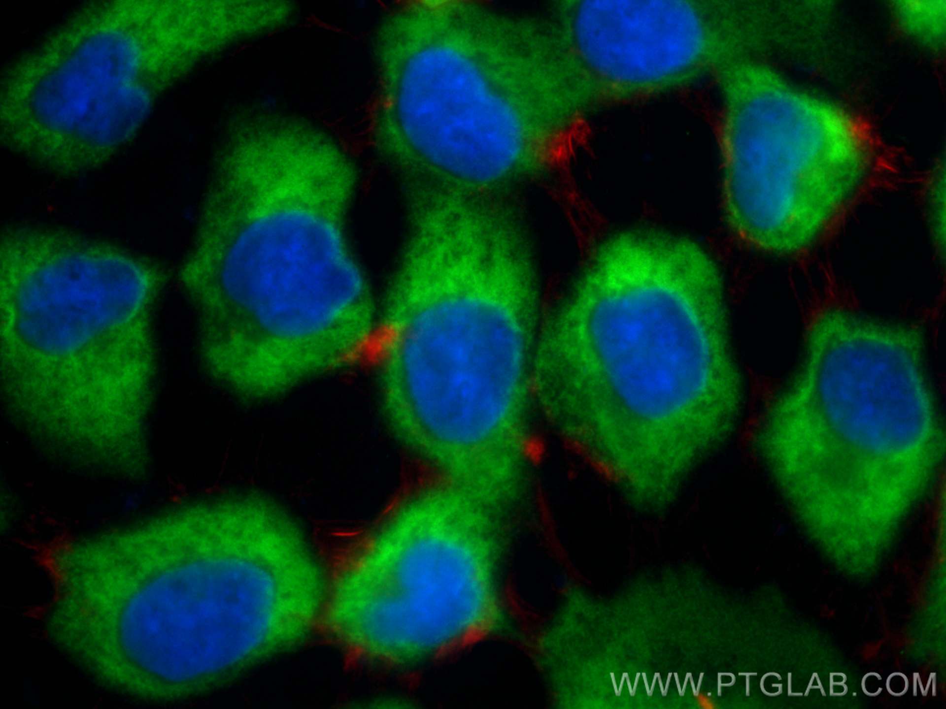 IF Staining of A431 using 14725-1-AP