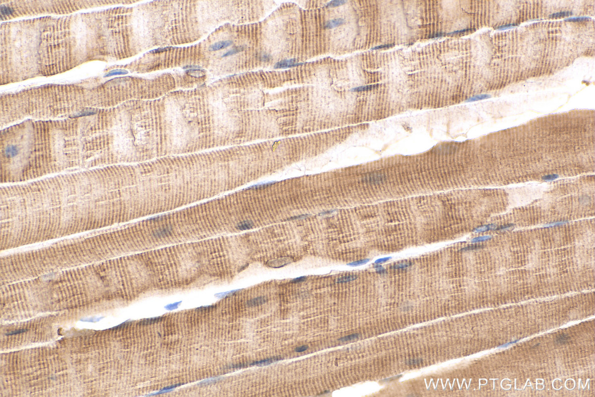 IHC staining of mouse skeletal muscle using 14725-1-AP