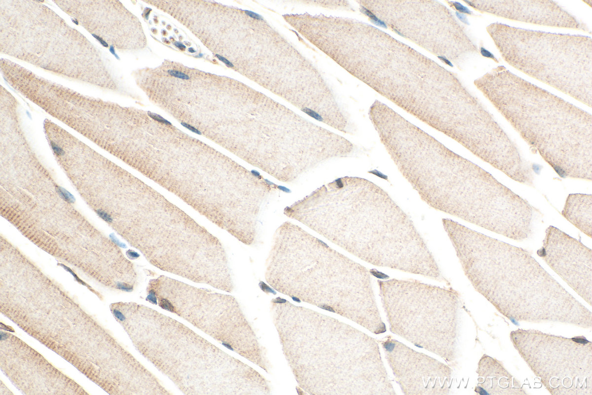 IHC staining of mouse skeletal muscle using 14725-1-AP