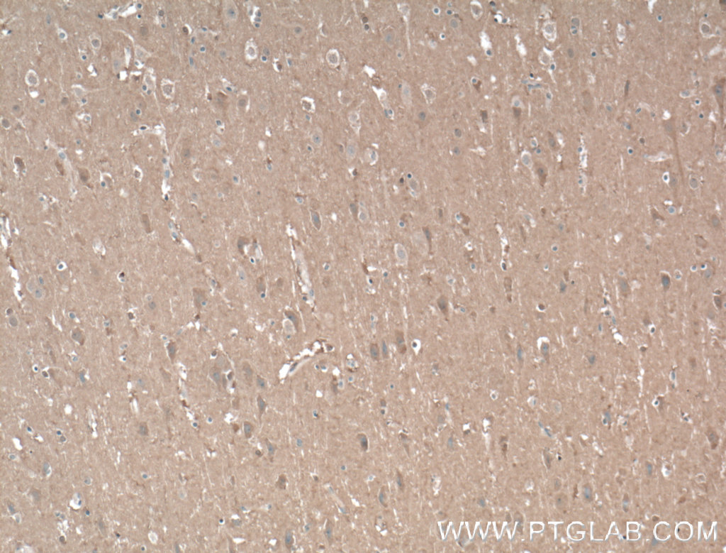 IHC staining of human brain using 55447-1-AP