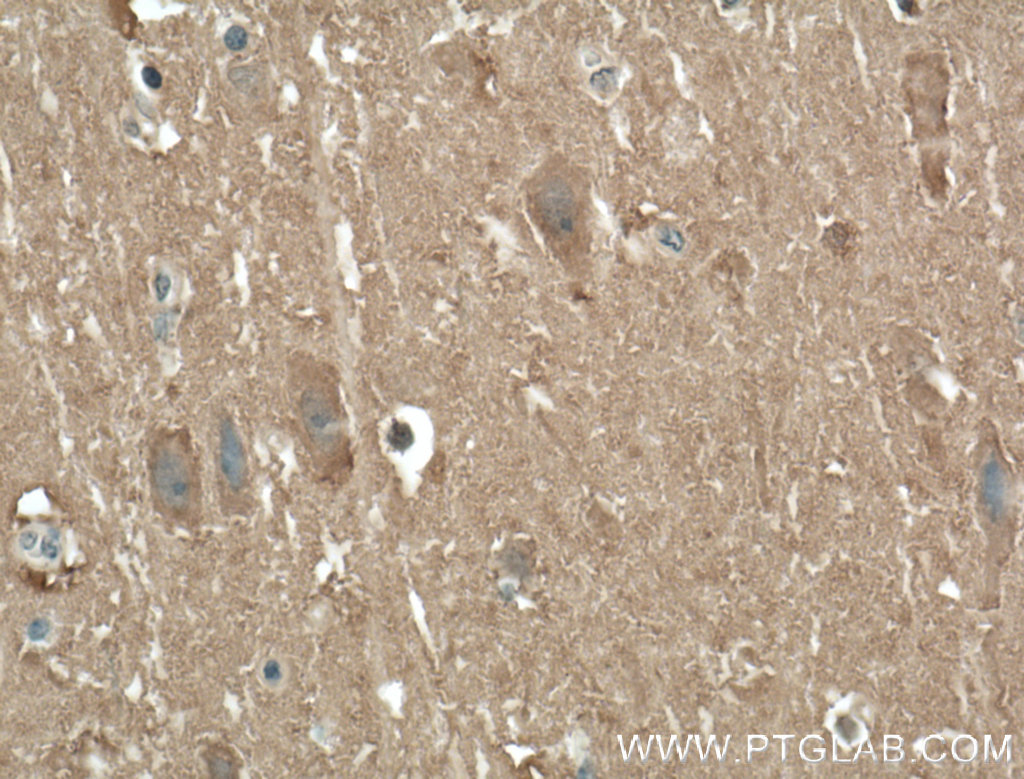 IHC staining of human brain using 55447-1-AP