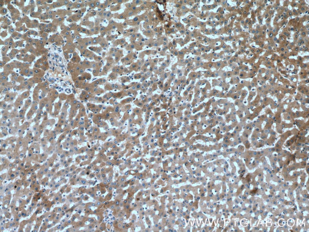 IHC staining of human liver using 16571-1-AP