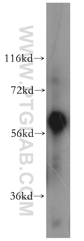 Fetuin-A Polyclonal antibody