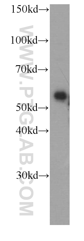 WB analysis of HepG2 using 66094-1-Ig