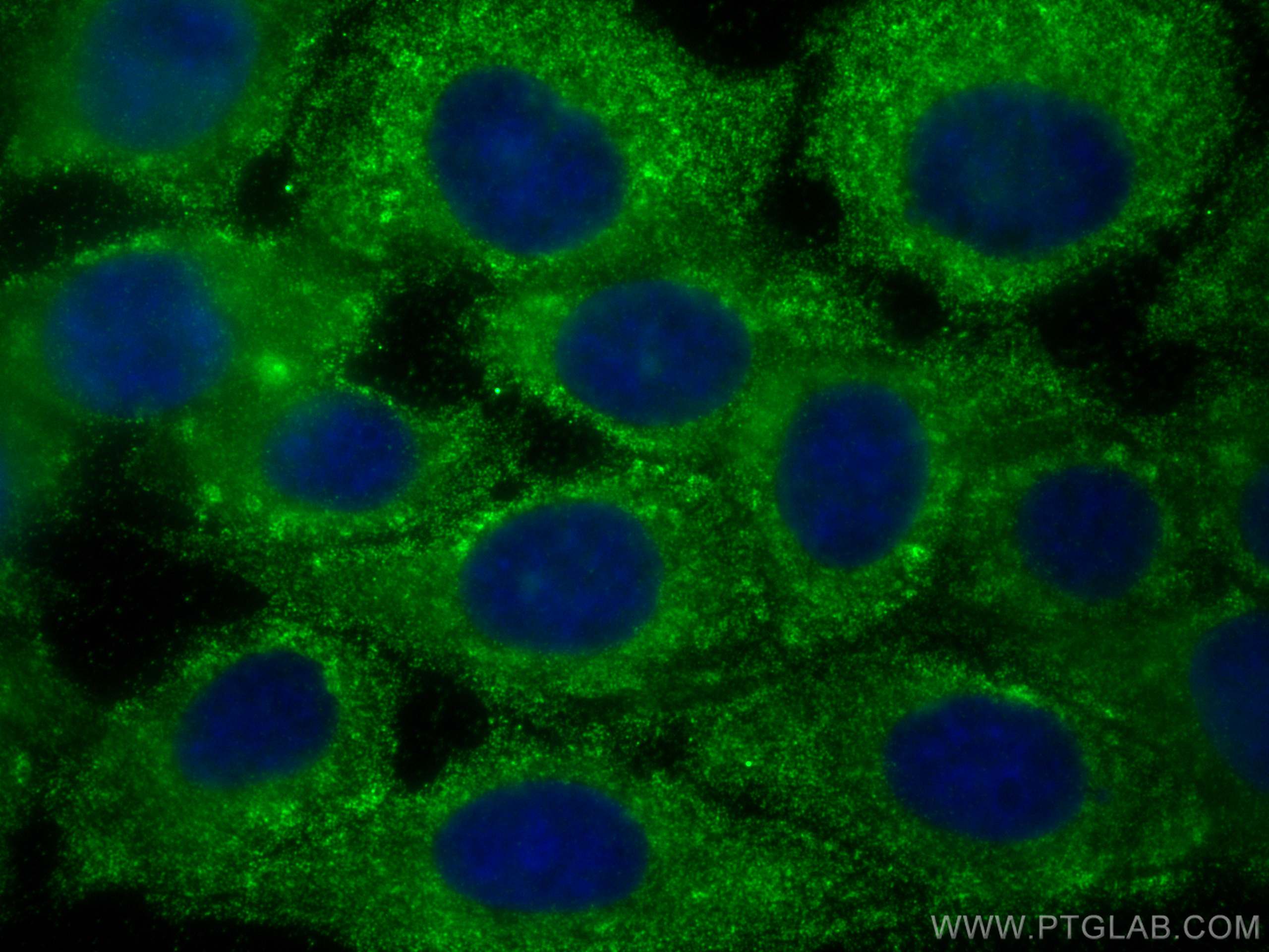 IF Staining of A431 using 68153-1-Ig (same clone as 68153-1-PBS)