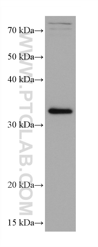 WB analysis of HepG2 using 68153-1-Ig