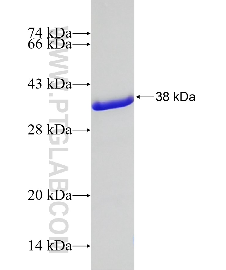 AIDA fusion protein Ag20597 SDS-PAGE
