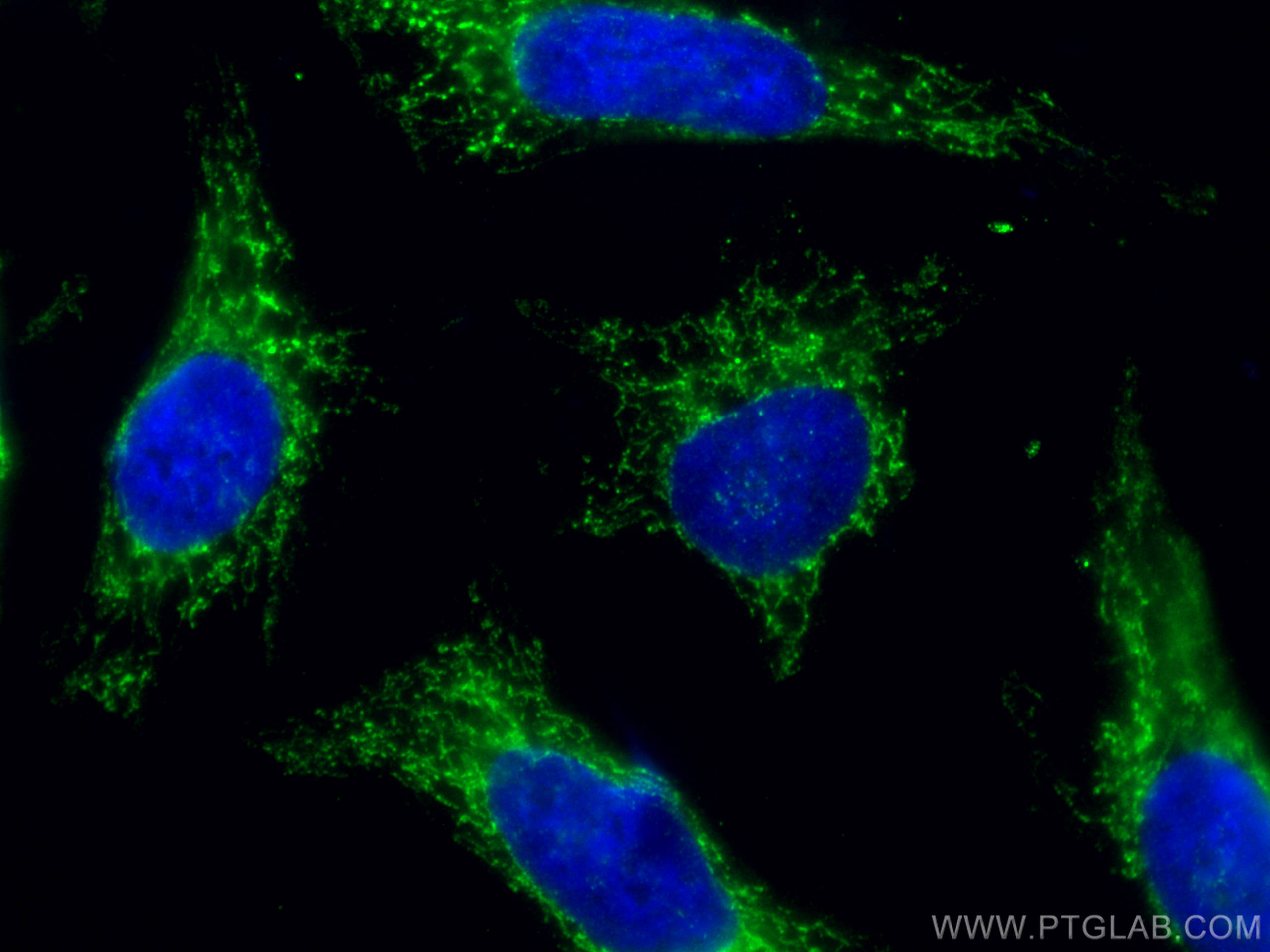 IF Staining of HeLa using 67791-1-Ig (same clone as 67791-1-PBS)