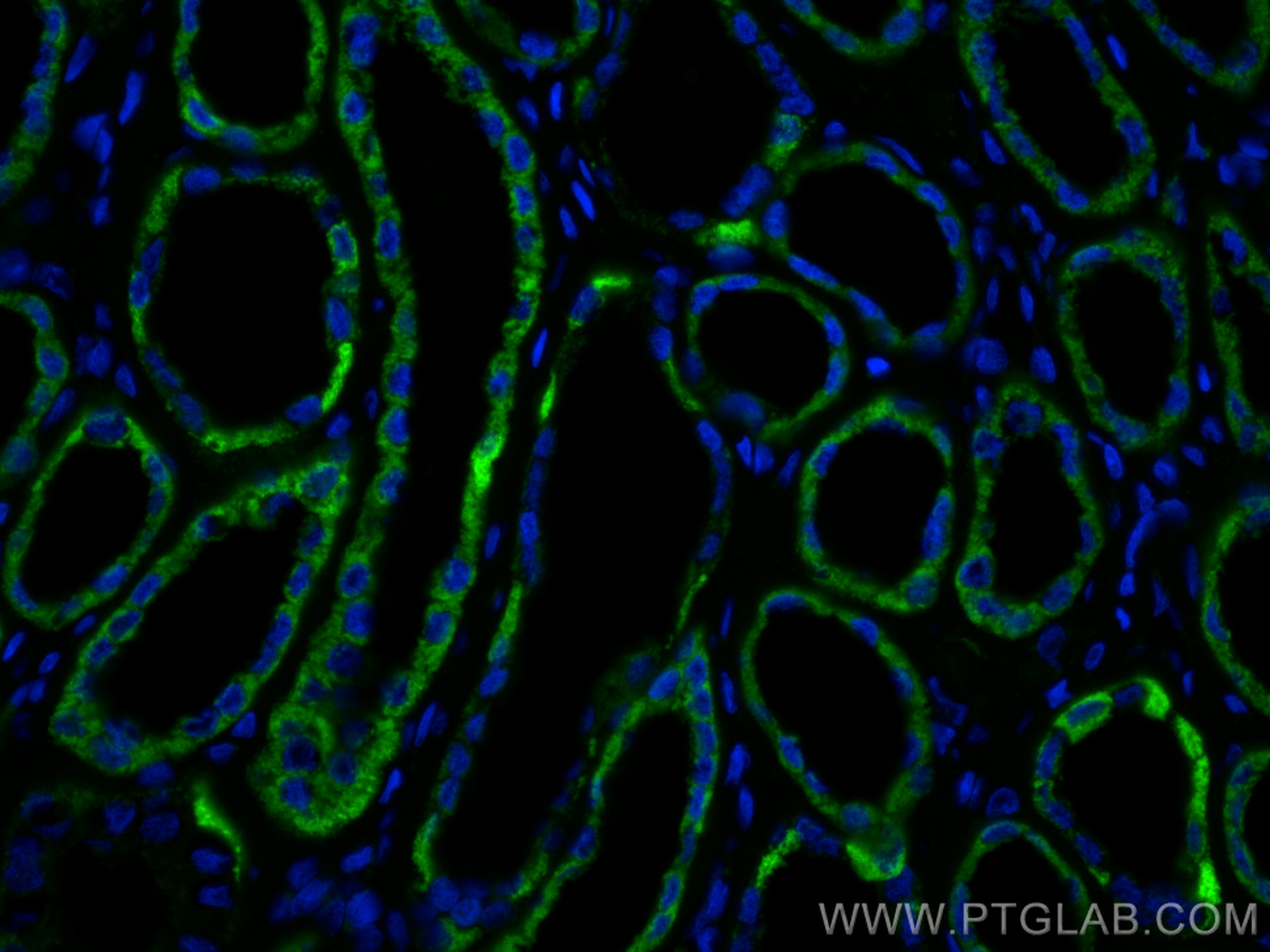 IF Staining of human kidney using 67791-1-Ig