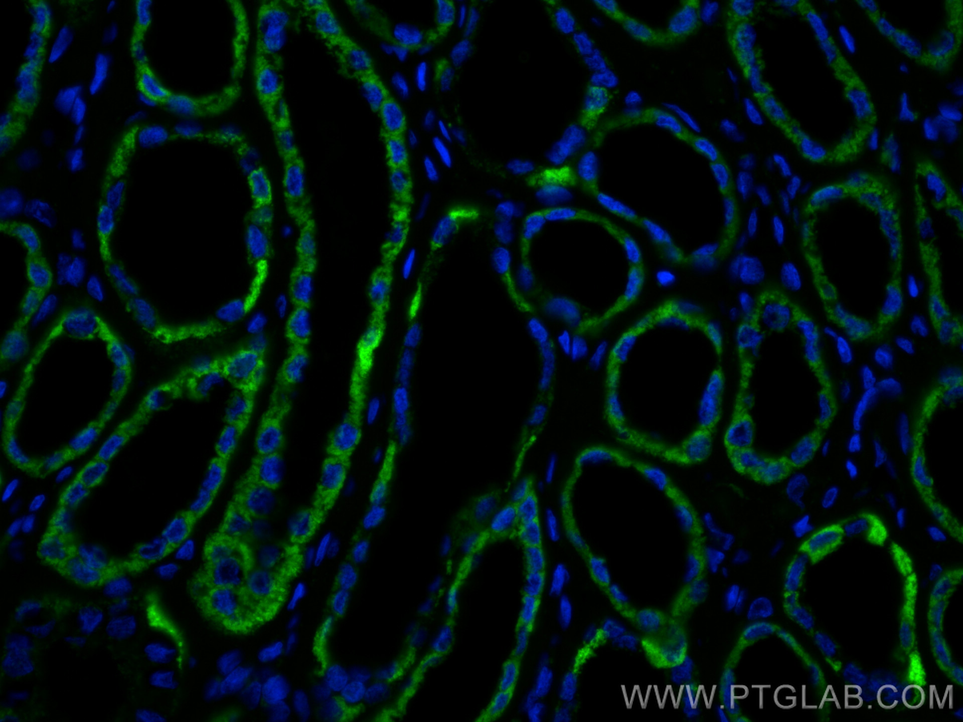 IF Staining of human kidney using 67791-1-Ig (same clone as 67791-1-PBS)