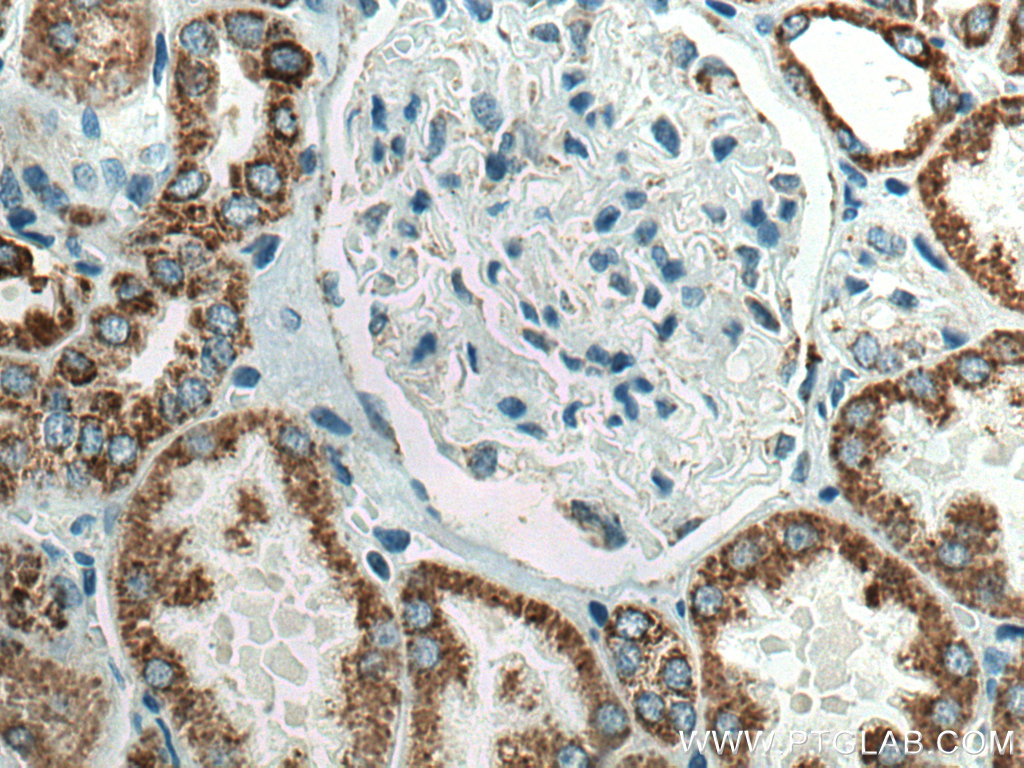 IHC staining of human kidney using 67791-1-Ig (same clone as 67791-1-PBS)