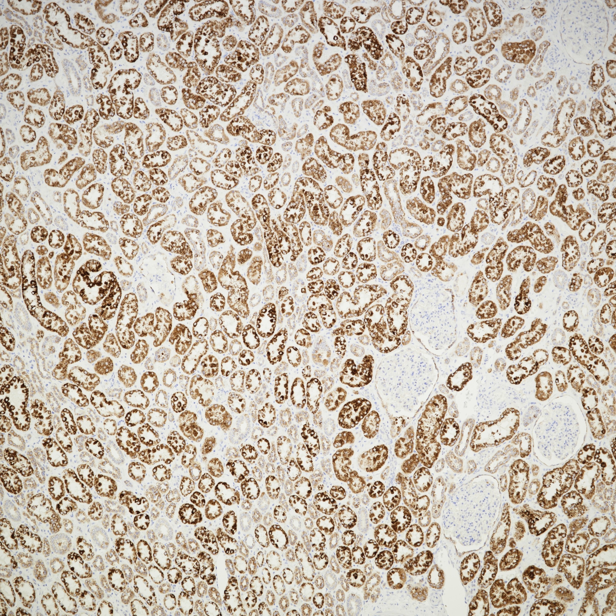 IHC staining of human kidney using 67791-1-Ig IHC staining of human kidney using 67791-1-Ig