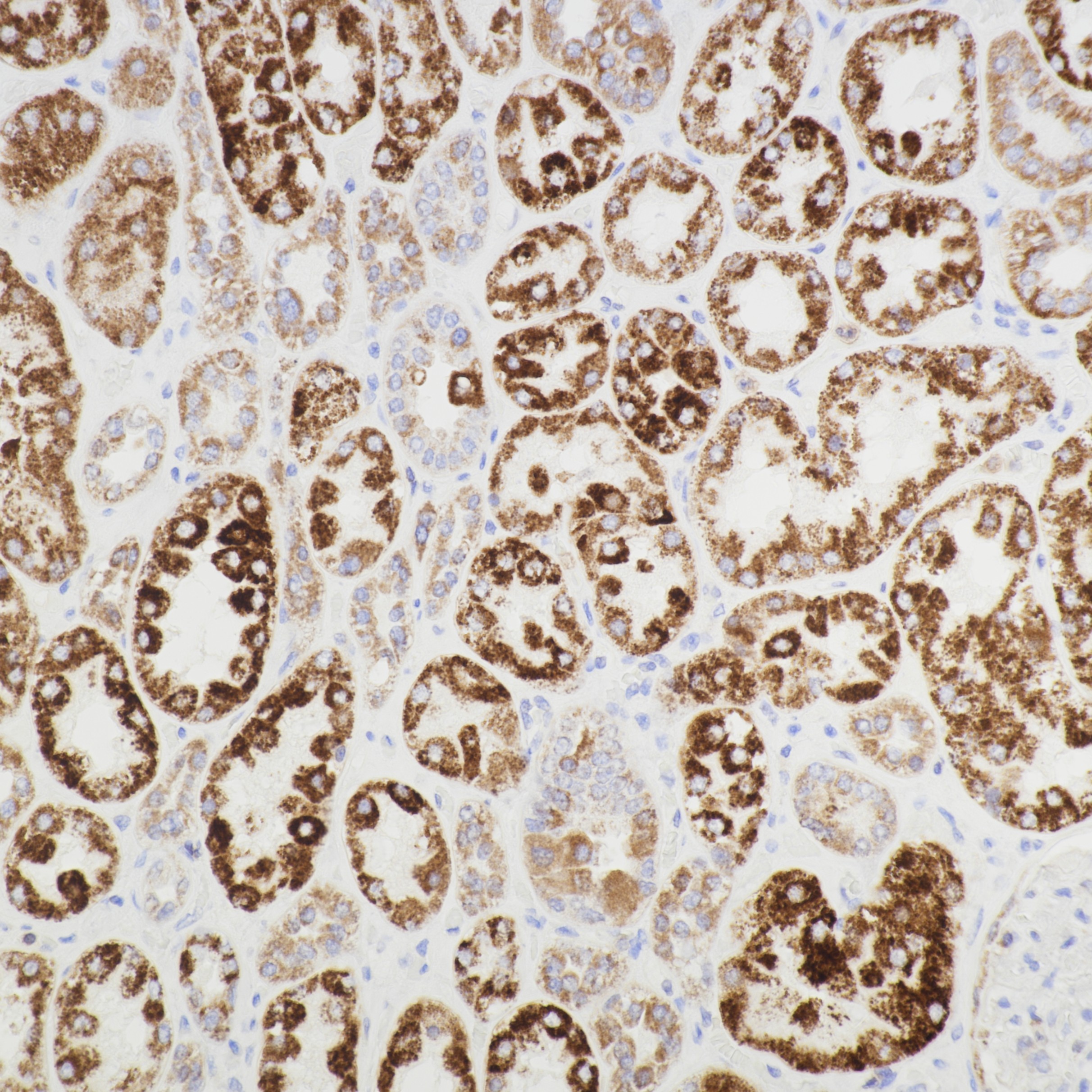 IHC staining of human kidney using 67791-1-Ig IHC staining of human kidney using 67791-1-Ig