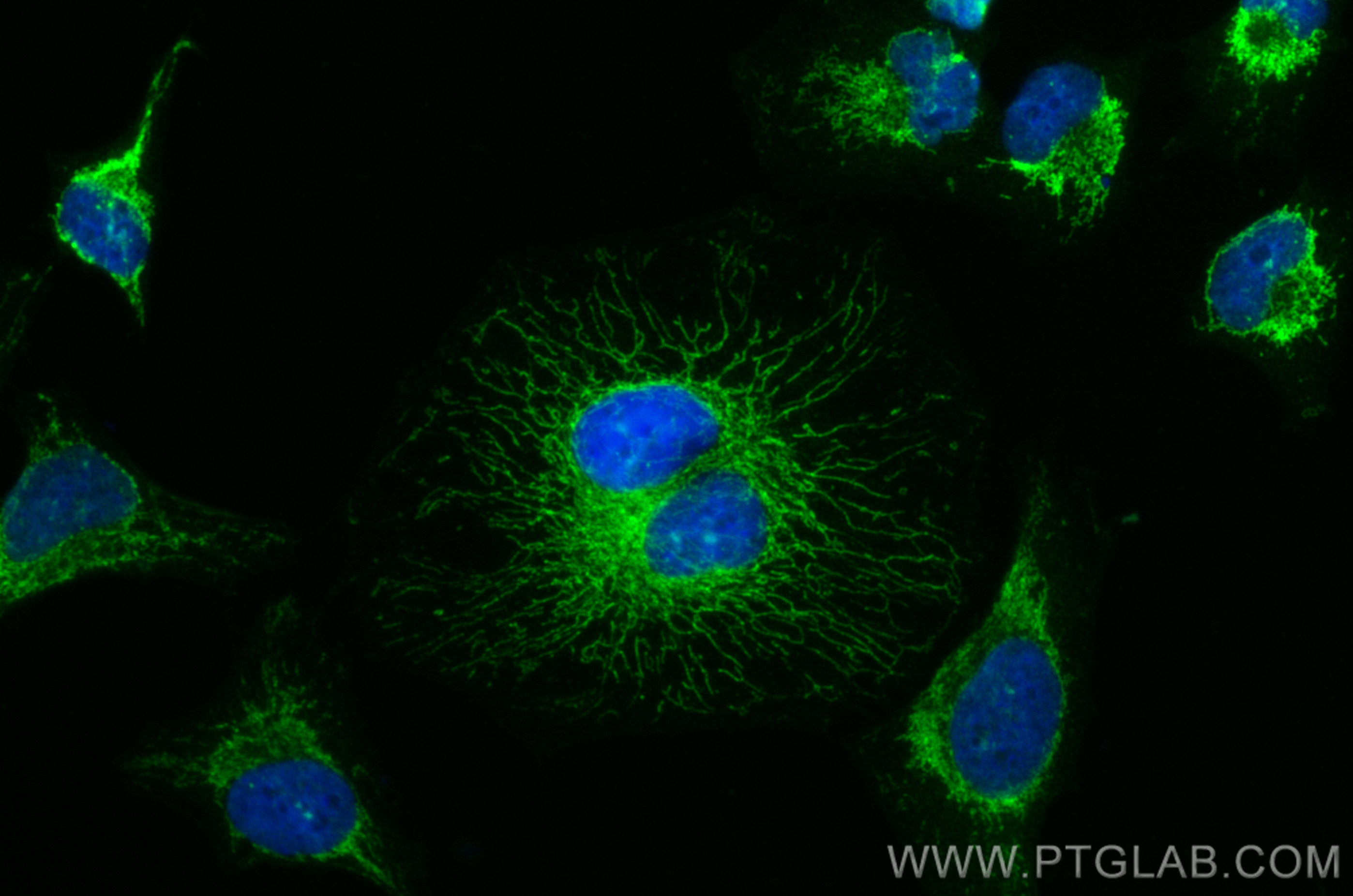 IF Staining of HeLa using CL488-17984