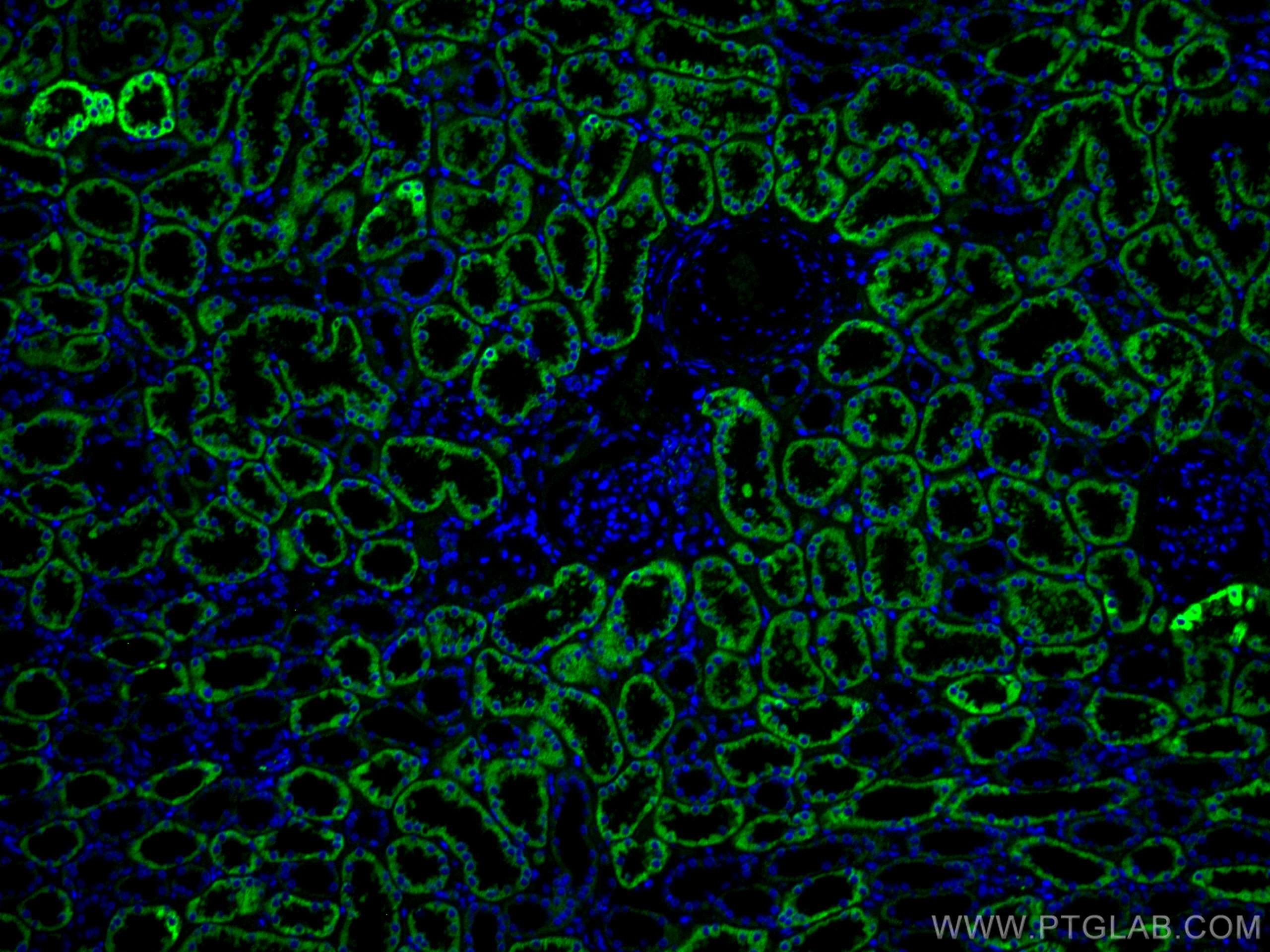 IF Staining of human kidney using CL488-67791
