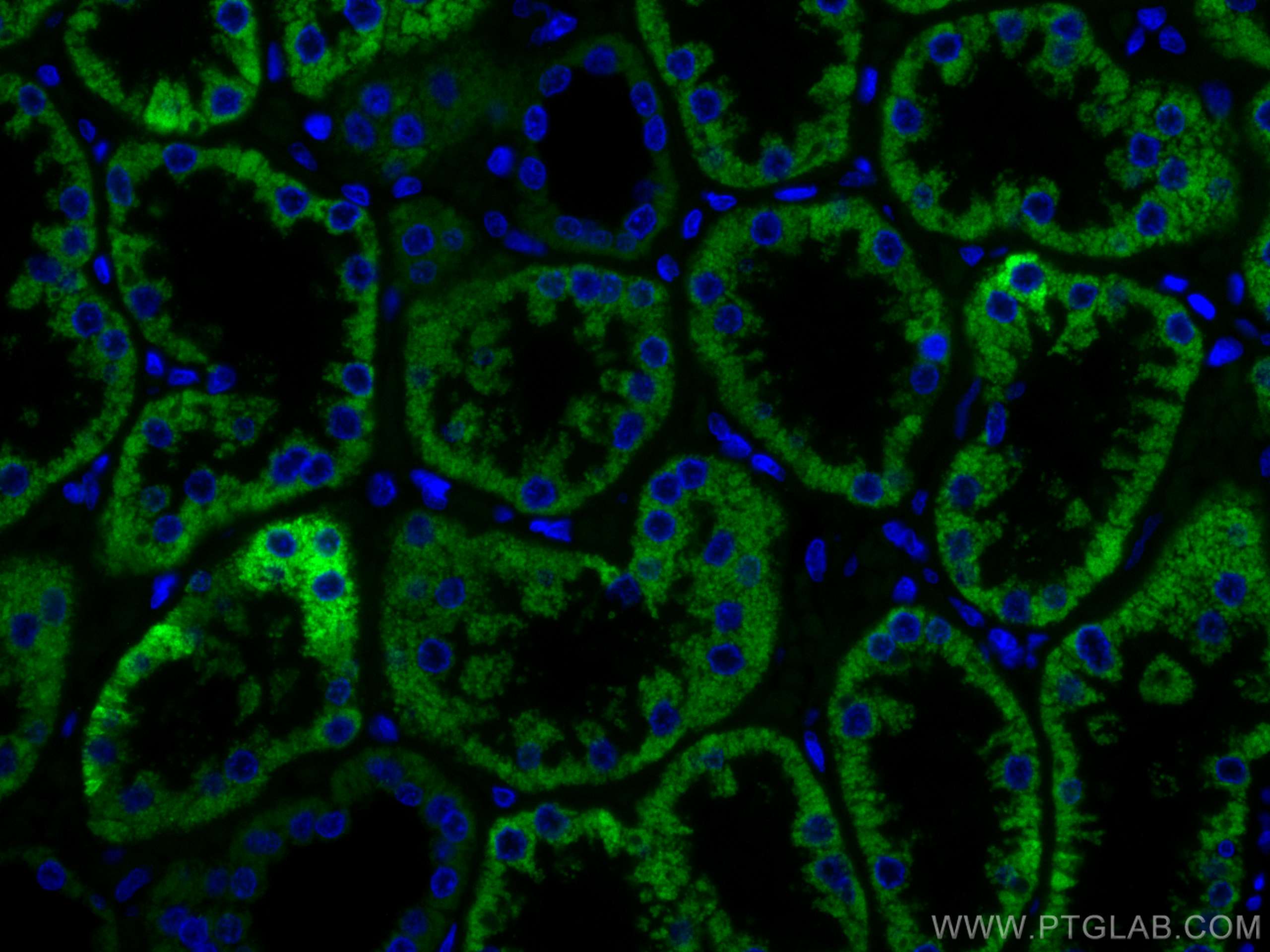 IF Staining of human kidney using CL488-67791