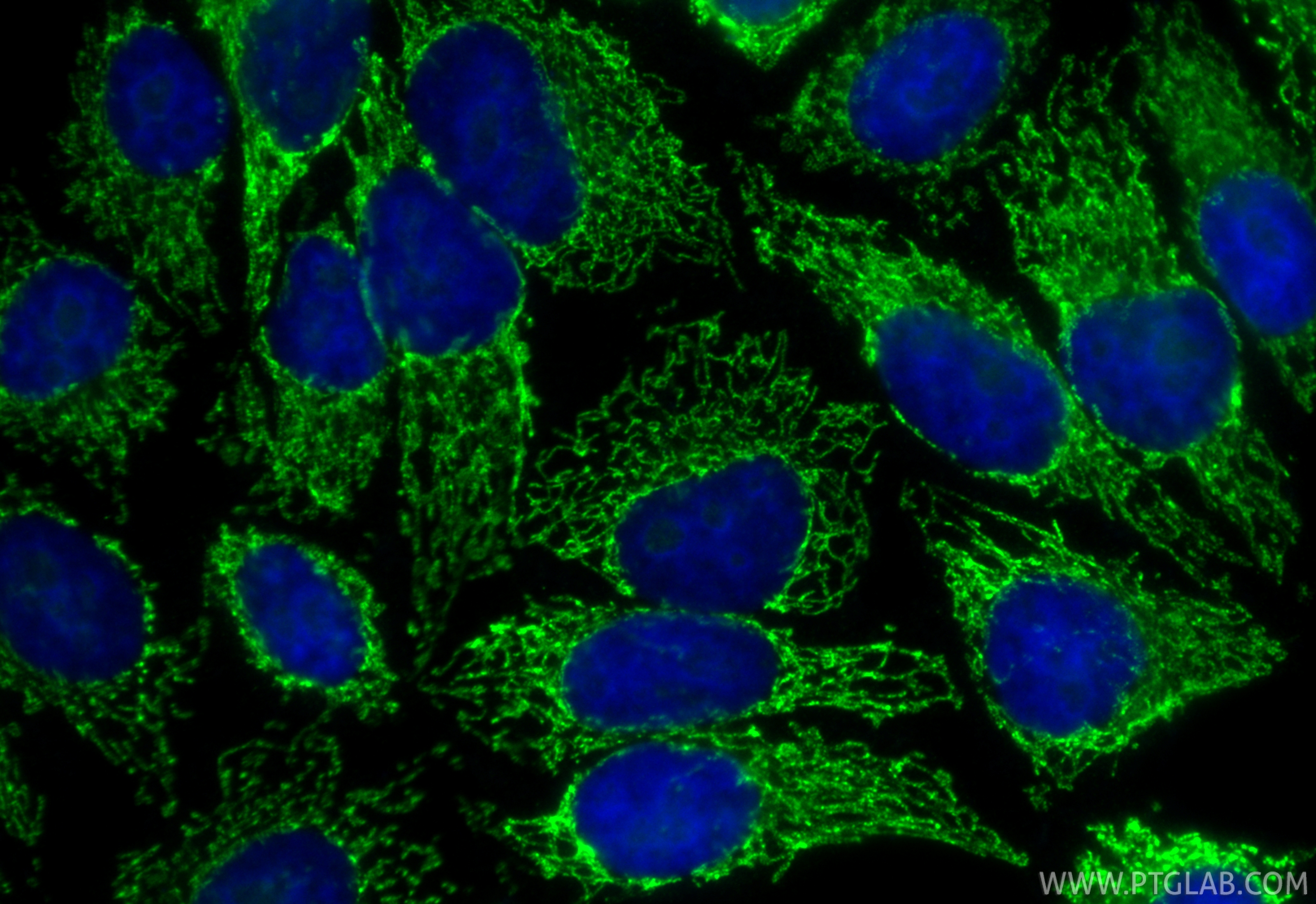 IF Staining of HepG2 using CL488-86156 IF Staining of HepG2 using CL488-86156