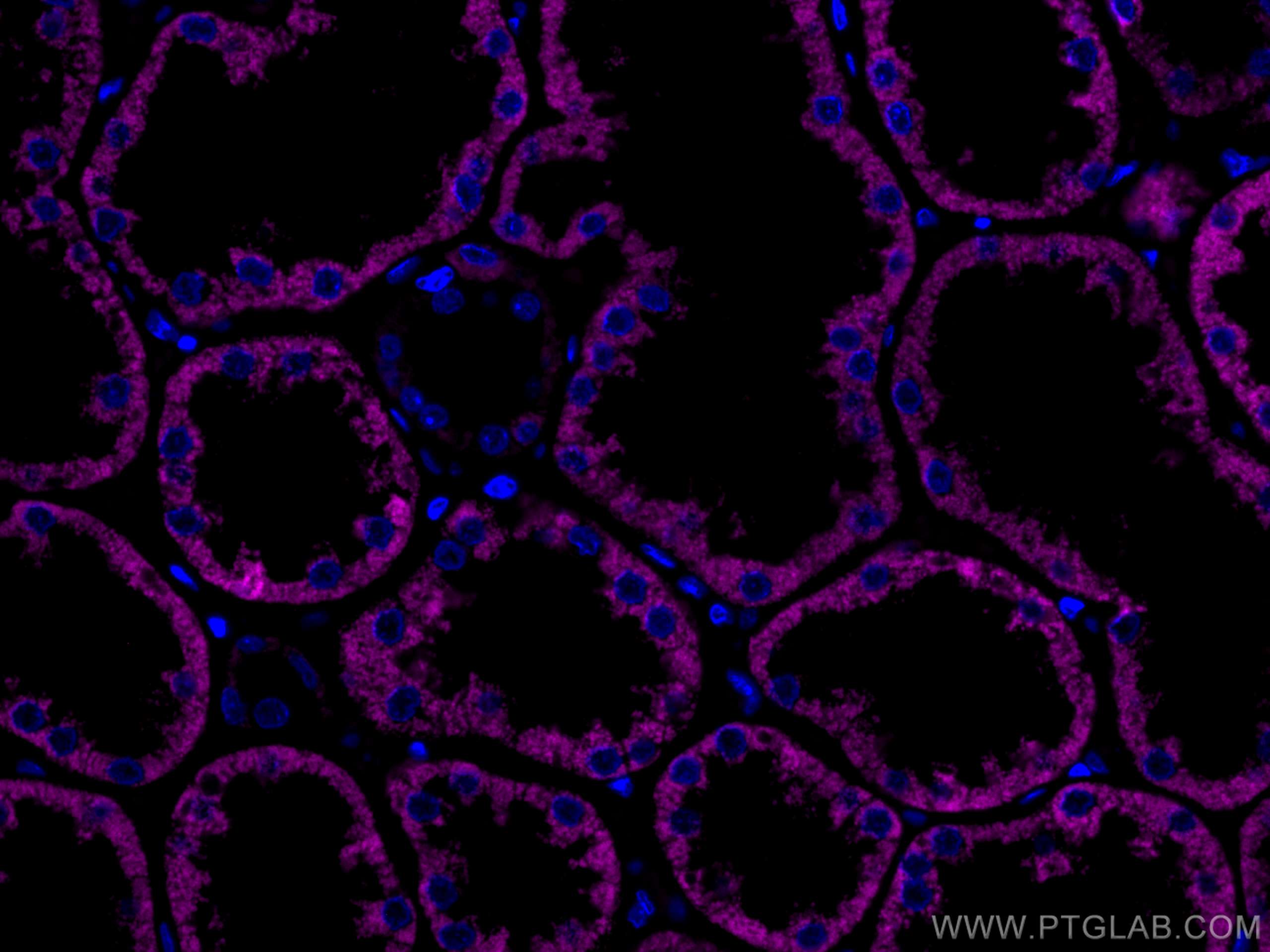 IF Staining of human kidney using CL647-67791