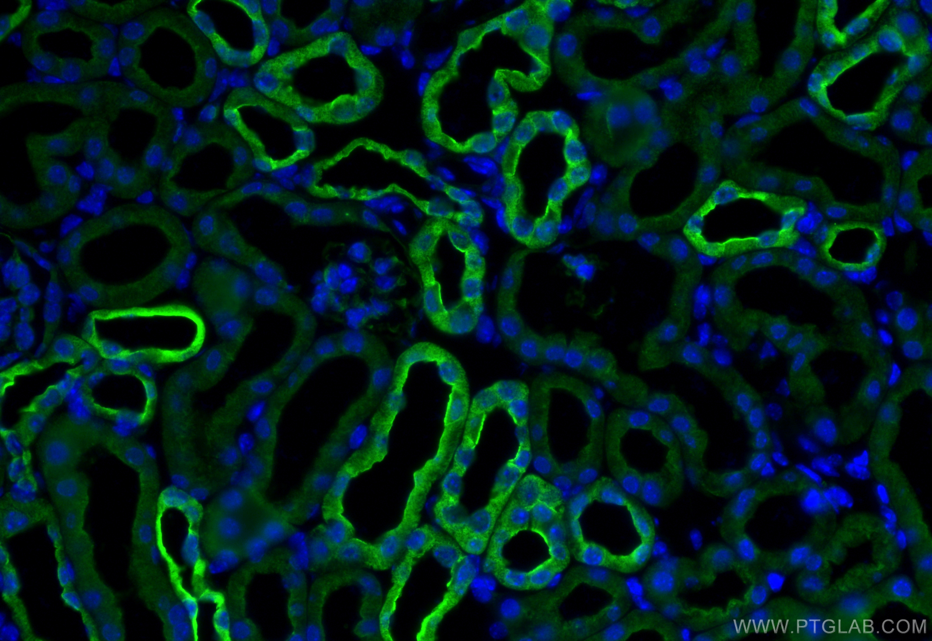 IF Staining of mouse kidney using 31569-1-AP