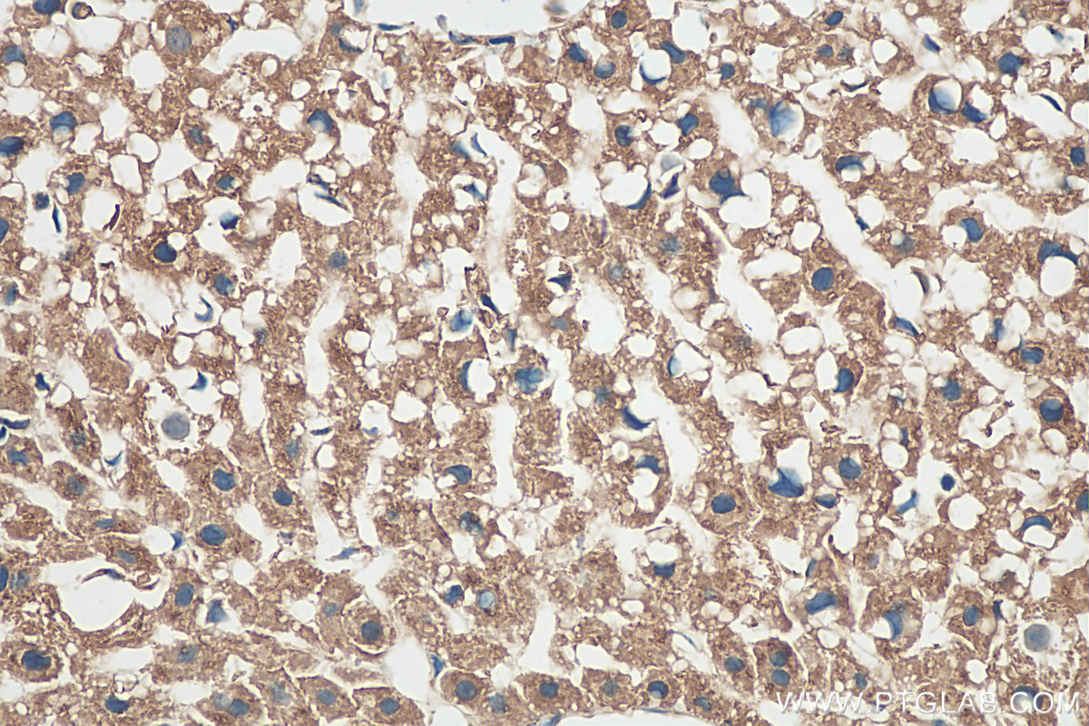 IHC staining of mouse liver using 20886-1-AP