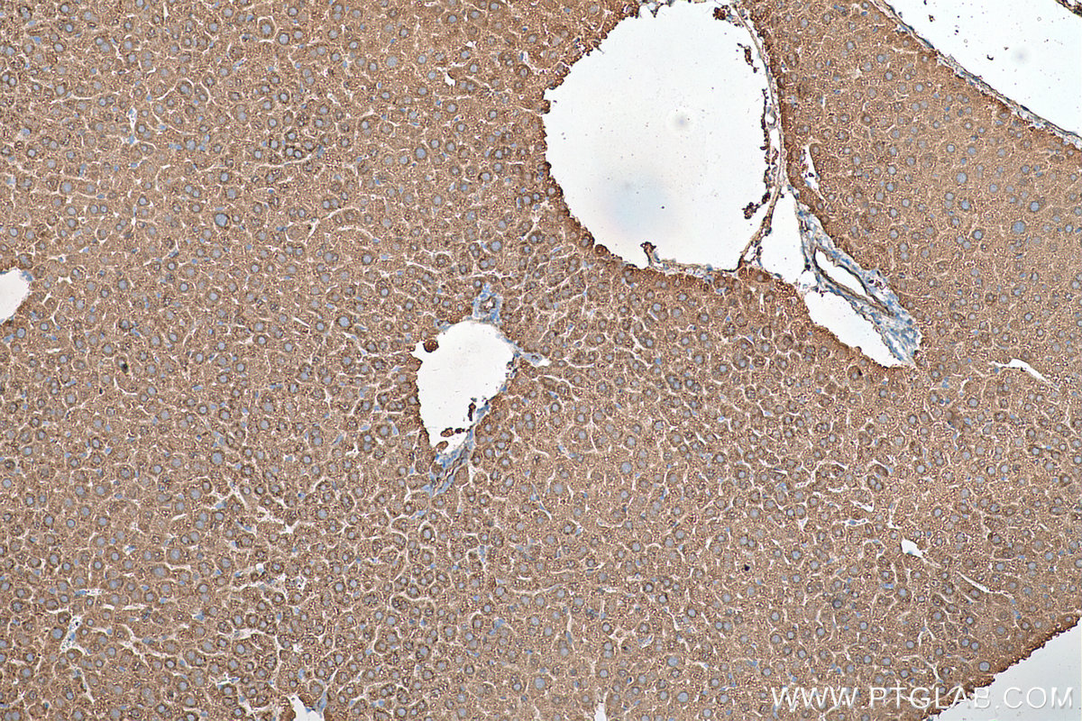 IHC staining of mouse liver using 68049-1-Ig