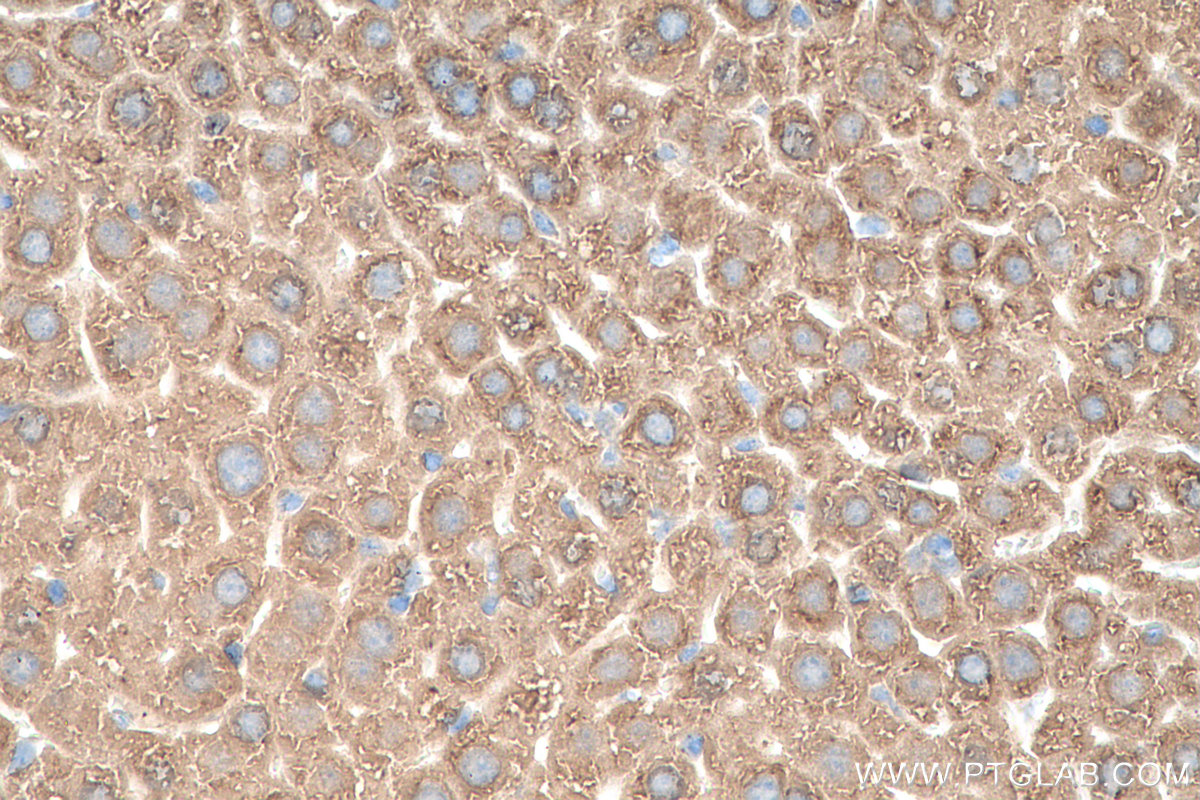 IHC staining of mouse liver using 68049-1-Ig