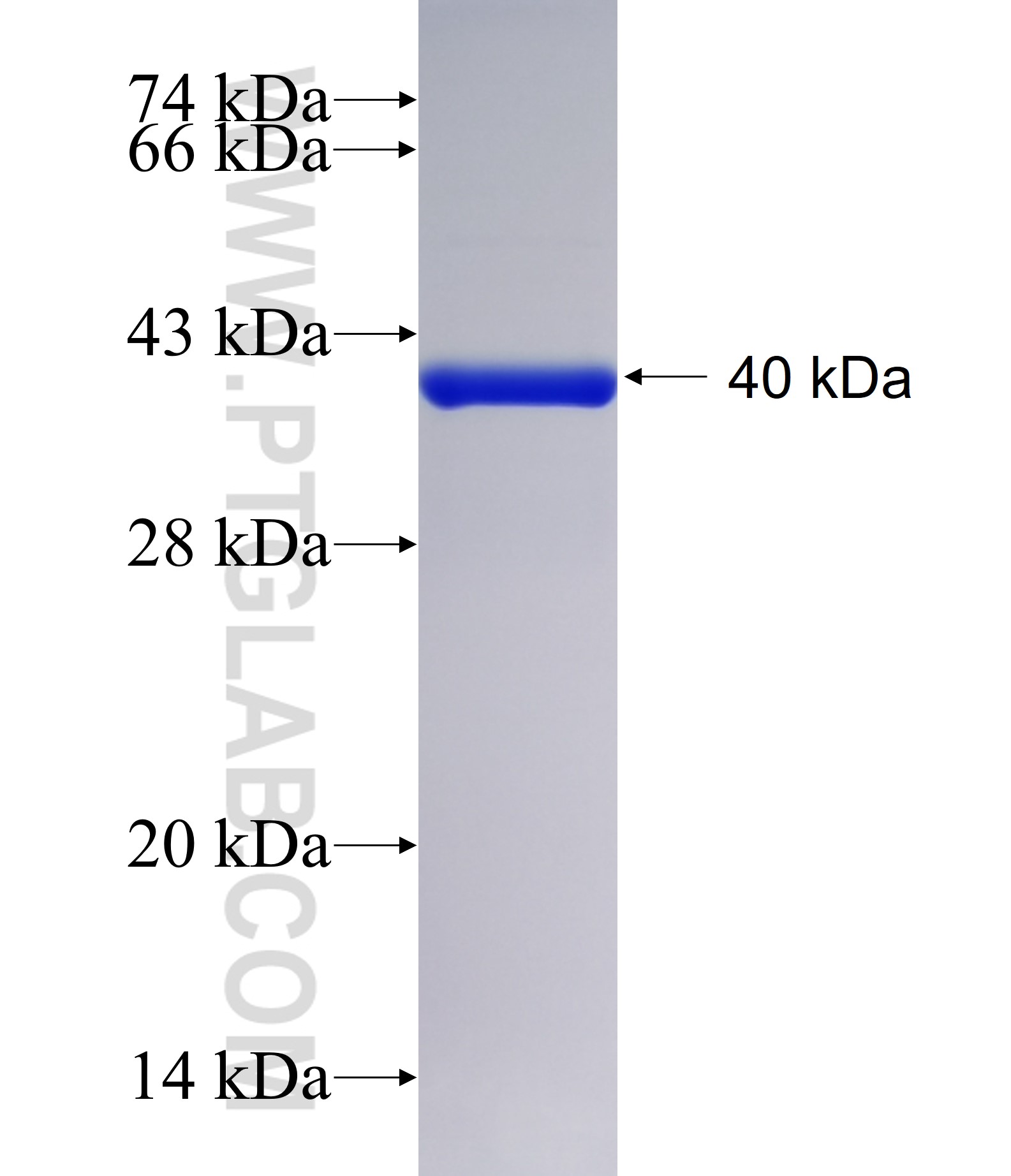 AIM1 fusion protein Ag39868 SDS-PAGE AIM1 fusion protein Ag39868 SDS-PAGE