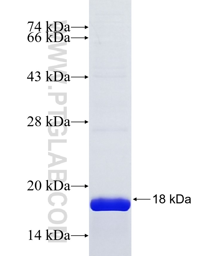 AIM1 fusion protein Ag39883 SDS-PAGE AIM1 fusion protein Ag39883 SDS-PAGE
