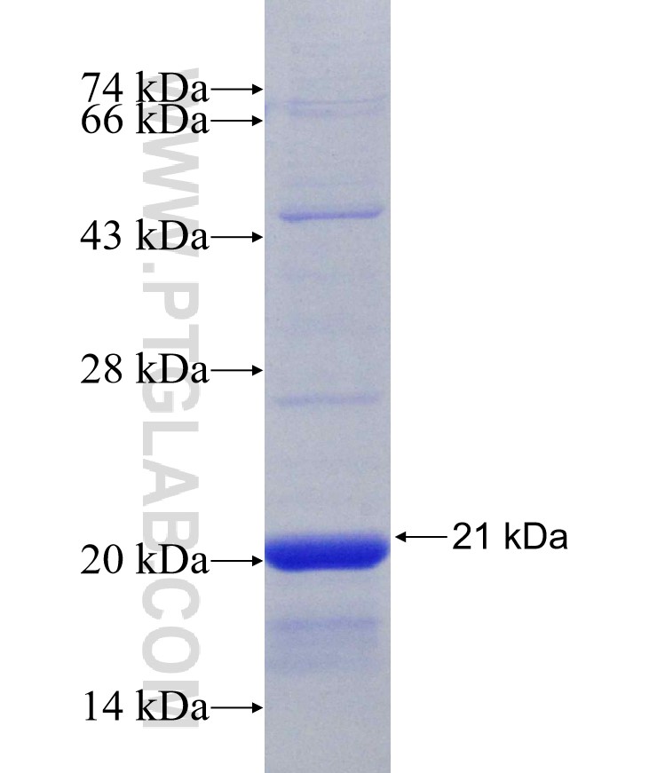 AIM2 fusion protein Ag30628 SDS-PAGE