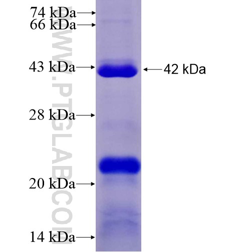 AIM2 fusion protein Ag14607 SDS-PAGE