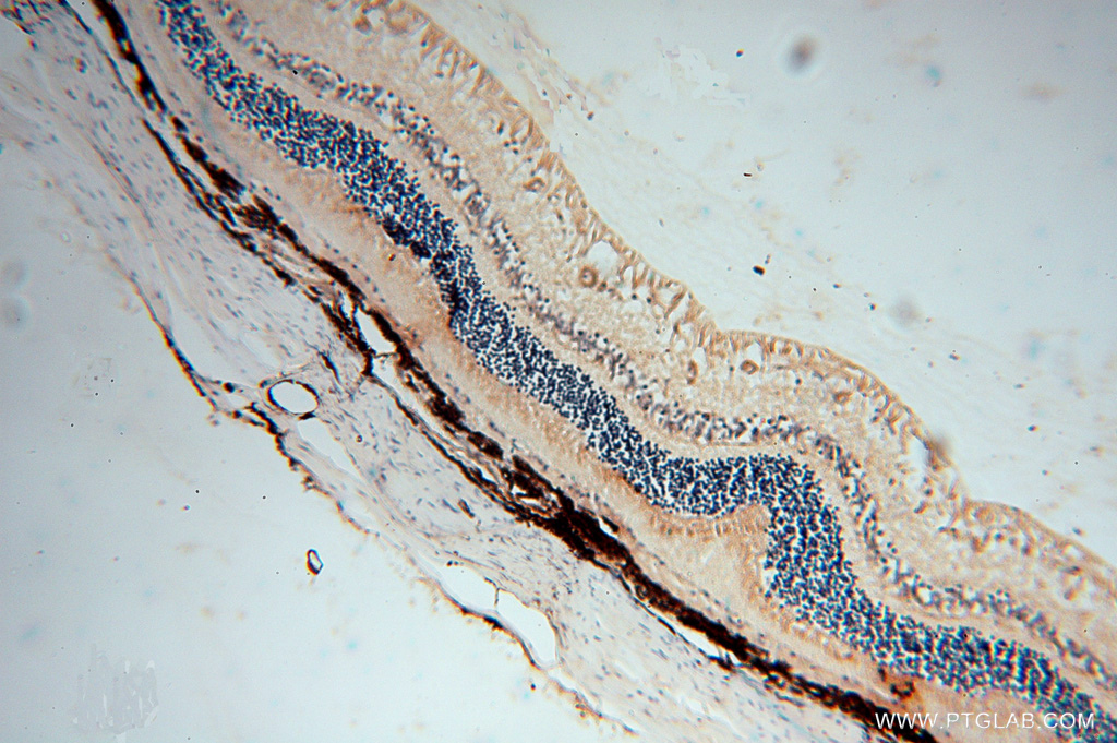 IHC staining of human eye using 15108-1-AP