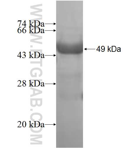 AIPL1 fusion protein Ag8149 SDS-PAGE