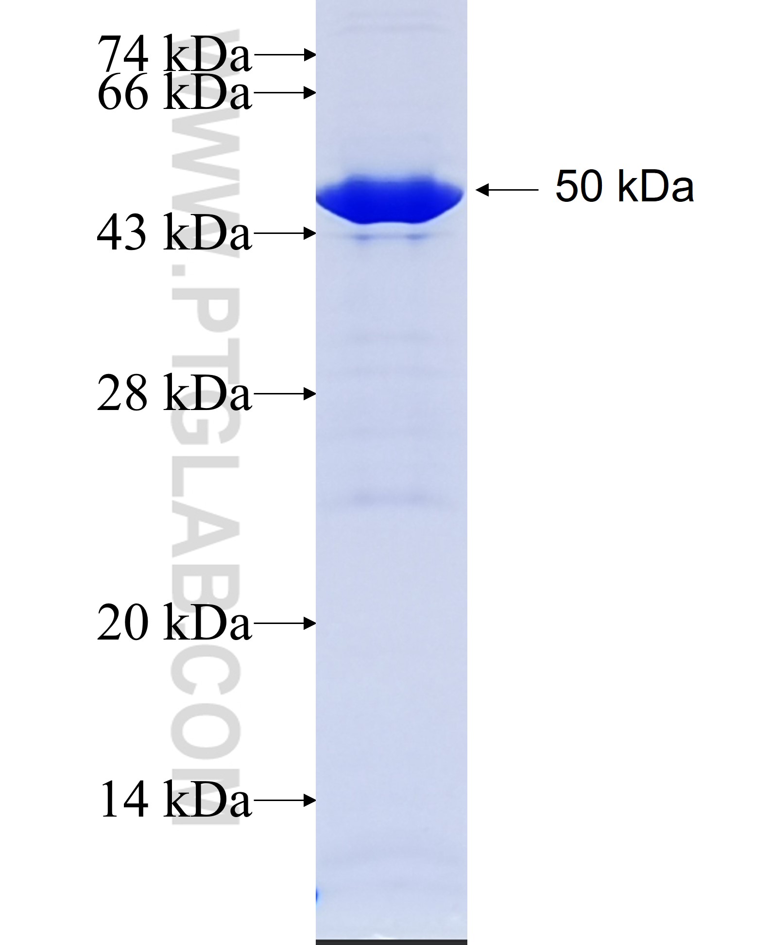 AIPL1 fusion protein Ag8149 SDS-PAGE