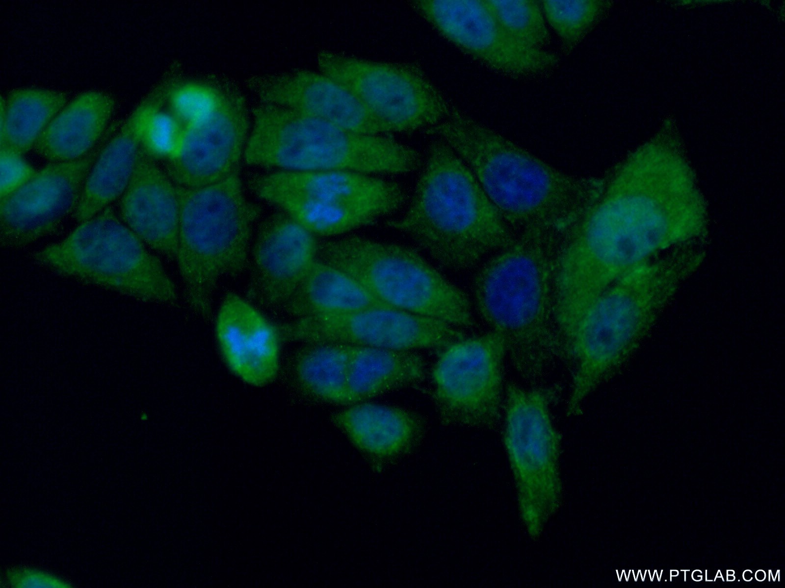 IF Staining of HeLa using 22517-1-AP