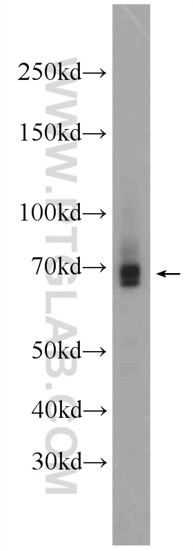 WB analysis of L02 using 22517-1-AP