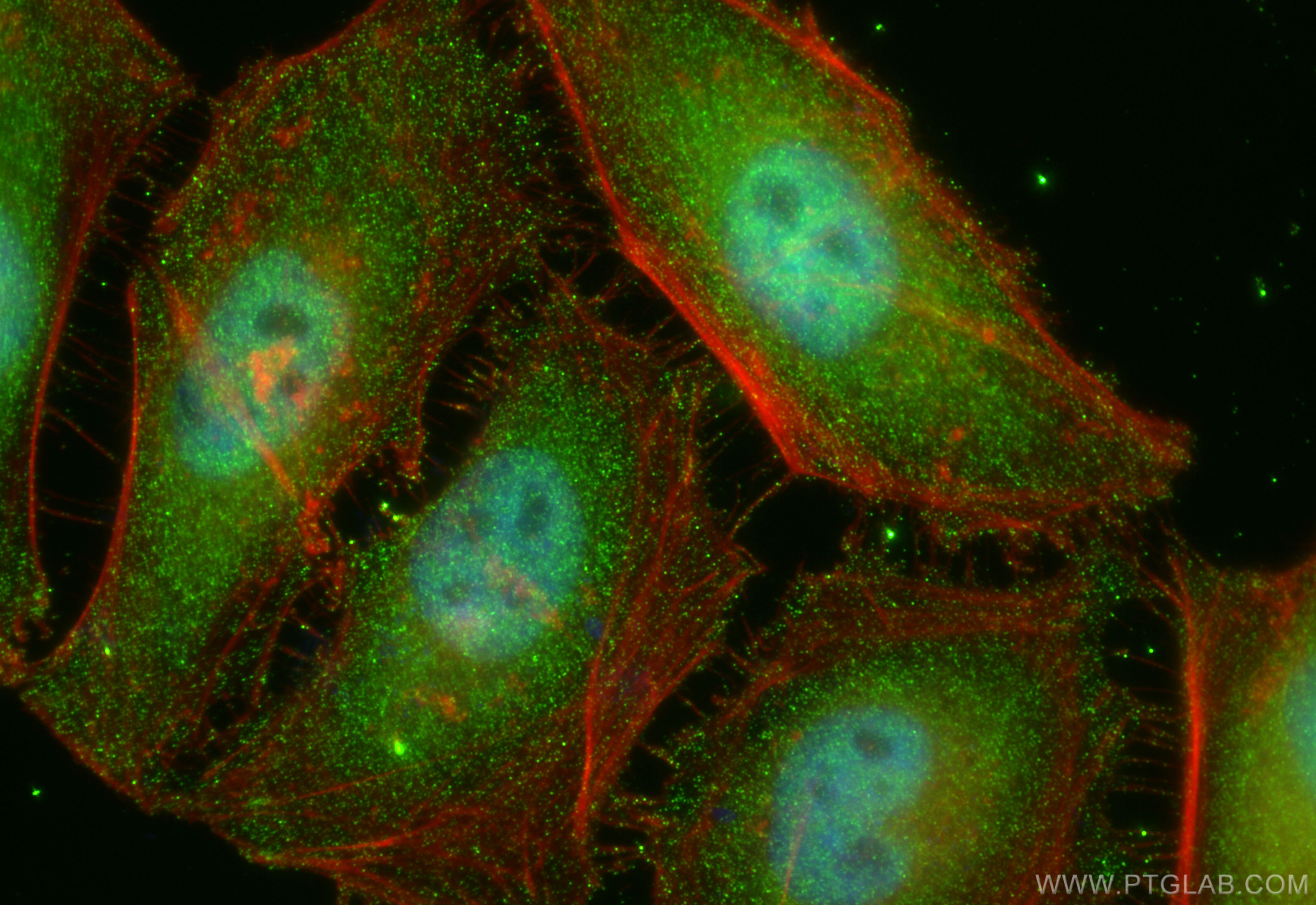 IF Staining of HeLa using 66262-1-Ig (same clone as 66262-1-PBS)