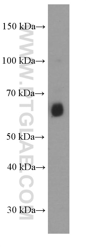 WB analysis of human spleen using 66262-1-Ig (same clone as 66262-1-PBS)