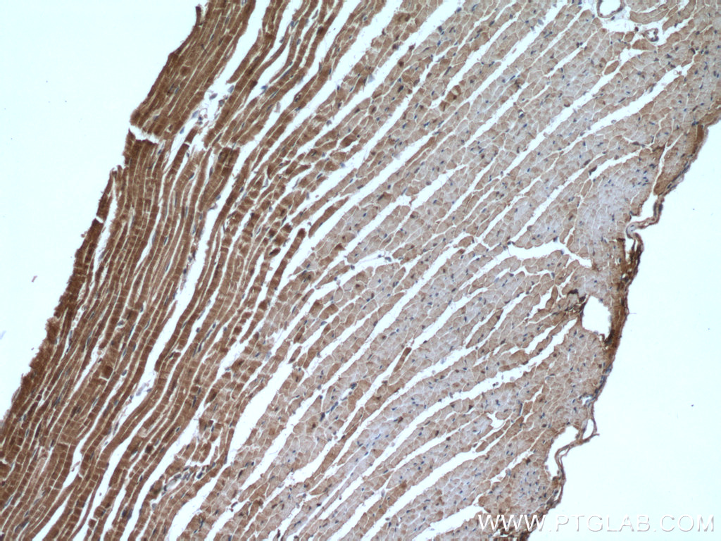 IHC staining of mouse heart using 14978-1-AP