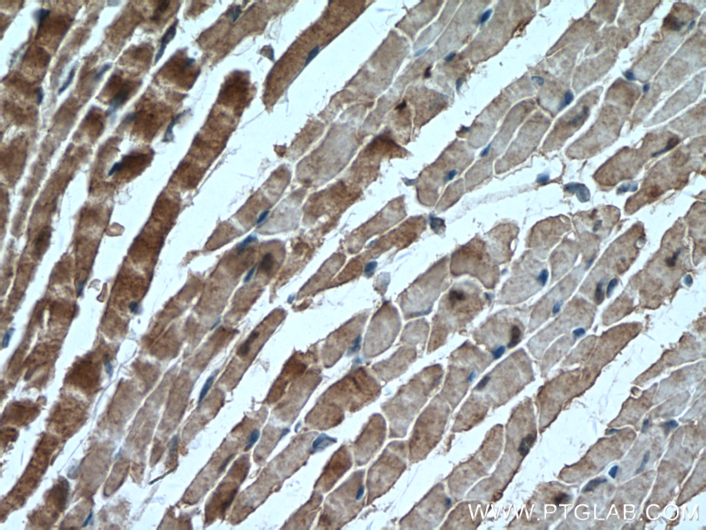 IHC staining of mouse heart using 14978-1-AP