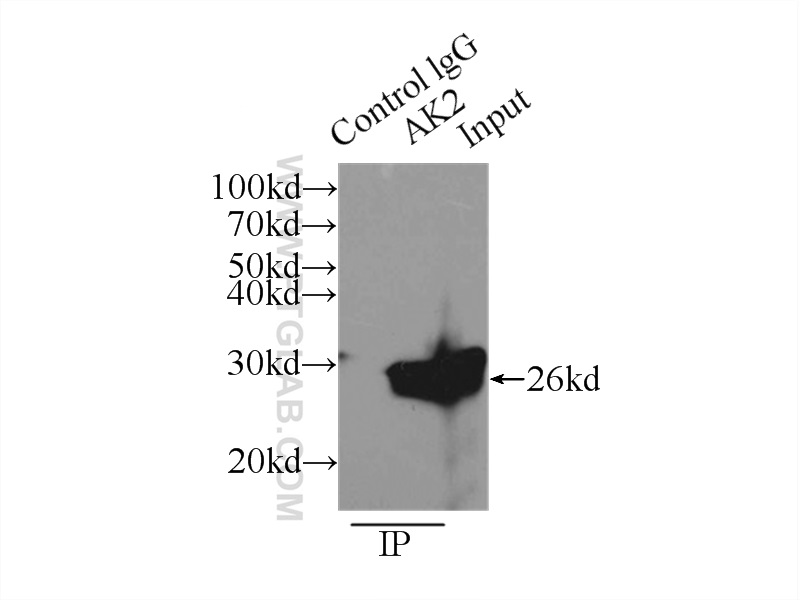 IP experiment of mouse liver using 11014-1-AP