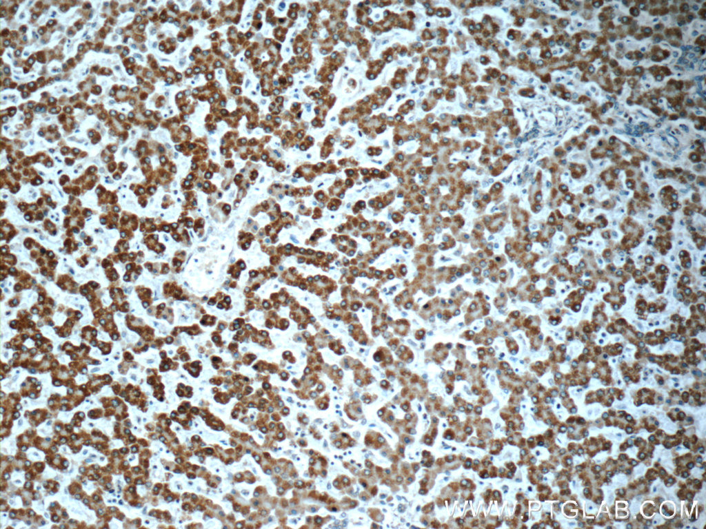 IHC staining of human liver using 66127-1-Ig (same clone as 66127-1-PBS)