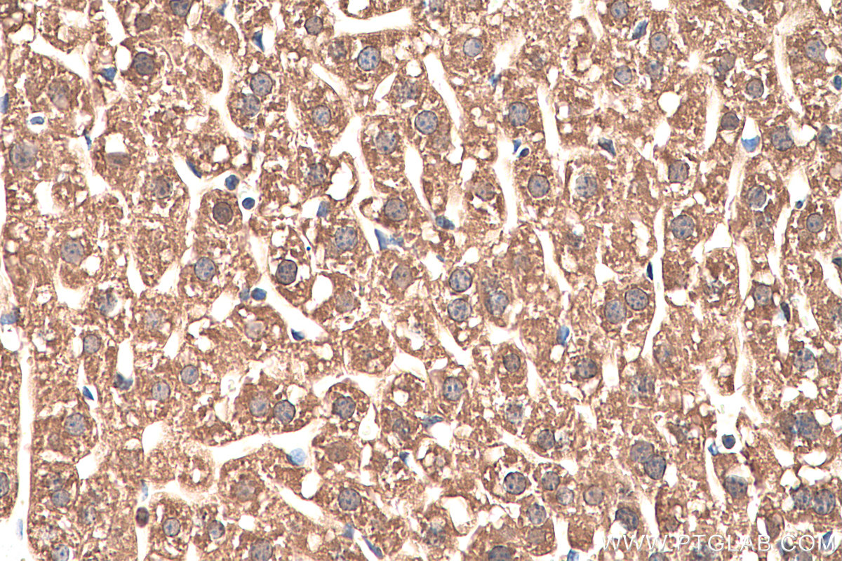 IHC staining of mouse liver using 66127-1-Ig (same clone as 66127-1-PBS)