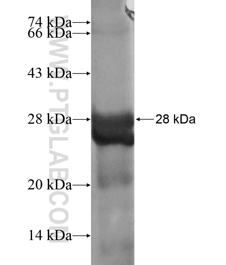 AK2 fusion protein Ag17911 SDS-PAGE