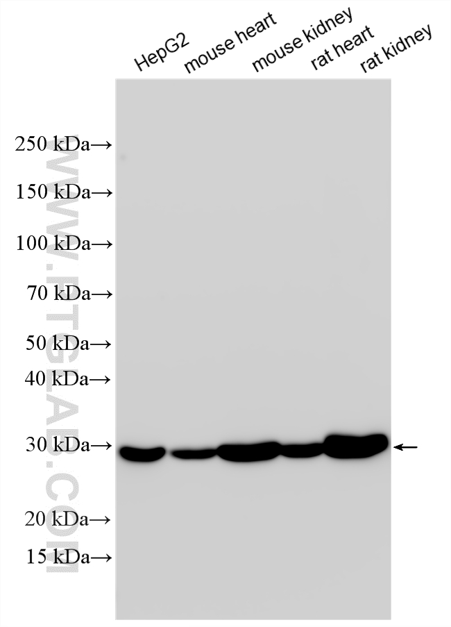 Various lysates were subjected to SDS PAGE followed by western blot with 12562-1-AP (AK3 antibody) at dilution of 1:15000 incubated at room temperature for 1.5 hours. WB analysis using 12562-1-AP