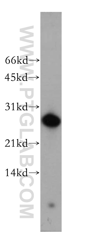 WB analysis of human placenta using 12562-1-AP