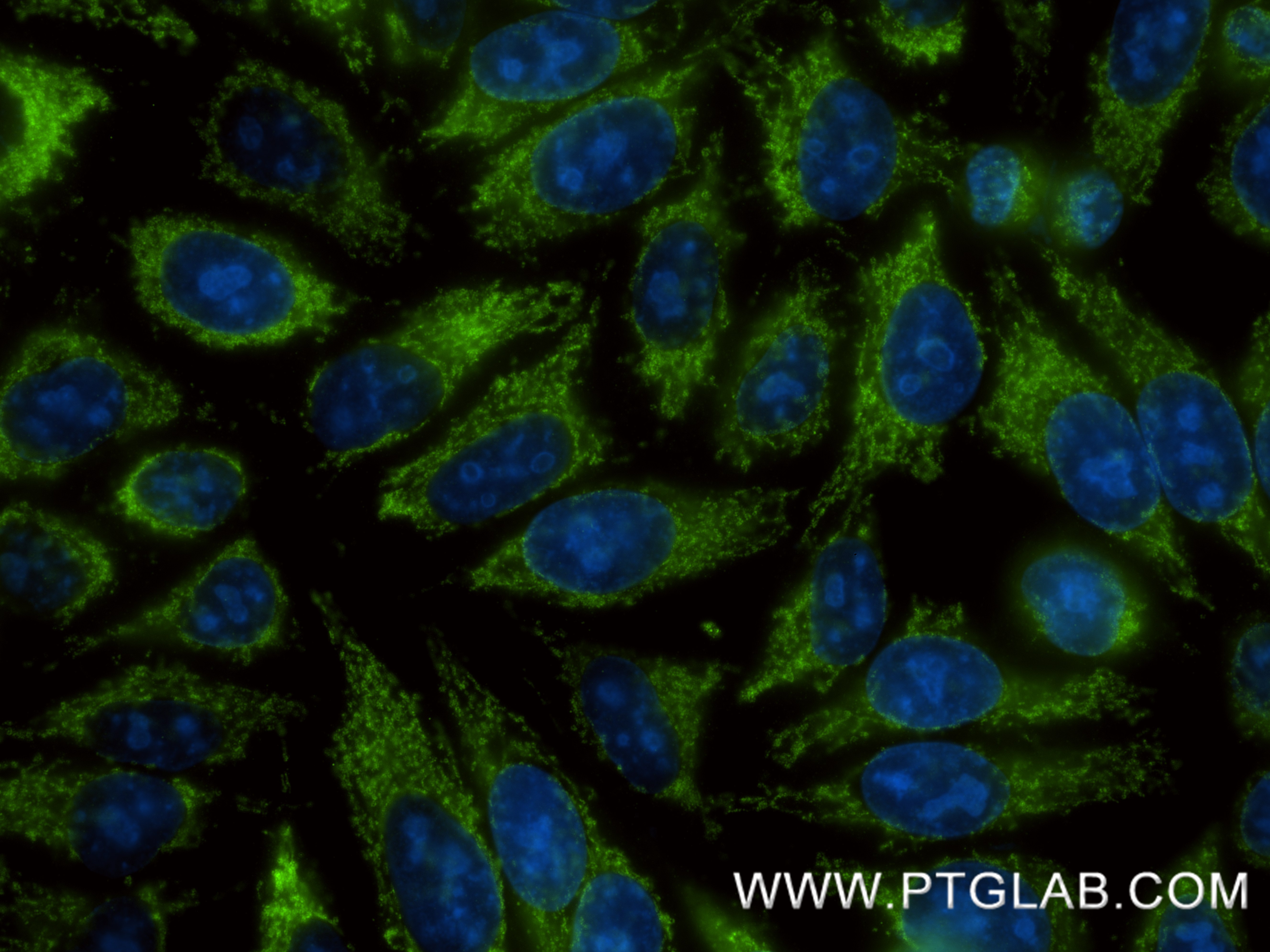IF Staining of HepG2 using 87090-3-RR IF Staining of HepG2 using 87090-3-RR