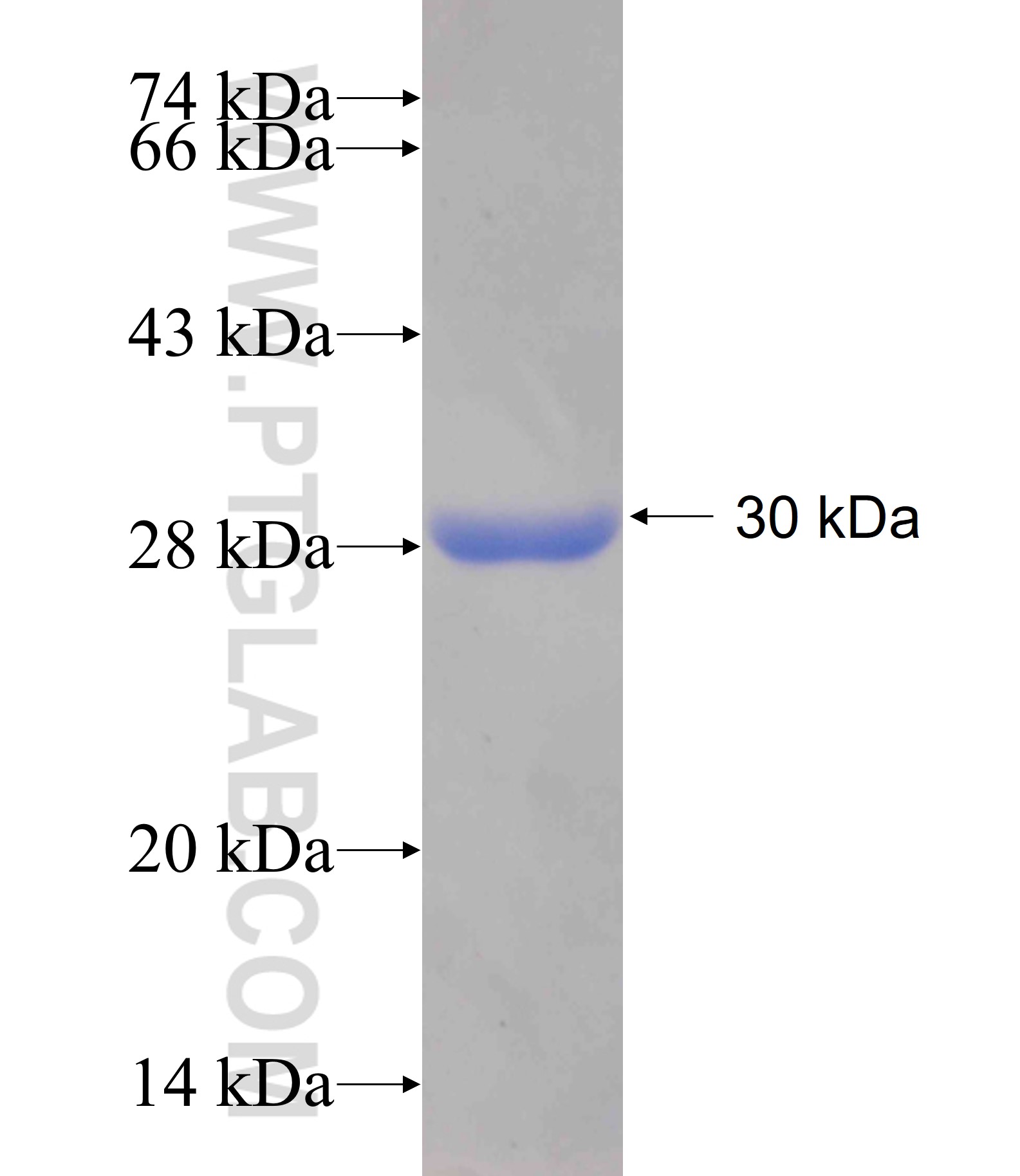 AK3 fusion protein Ag17424 SDS-PAGE AK3 fusion protein Ag17424 SDS-PAGE