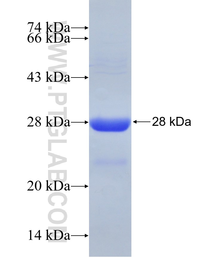 AK6 fusion protein Ag29518 SDS-PAGE